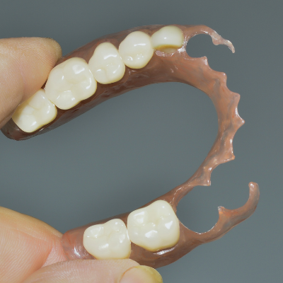 Prosthodontics: denture